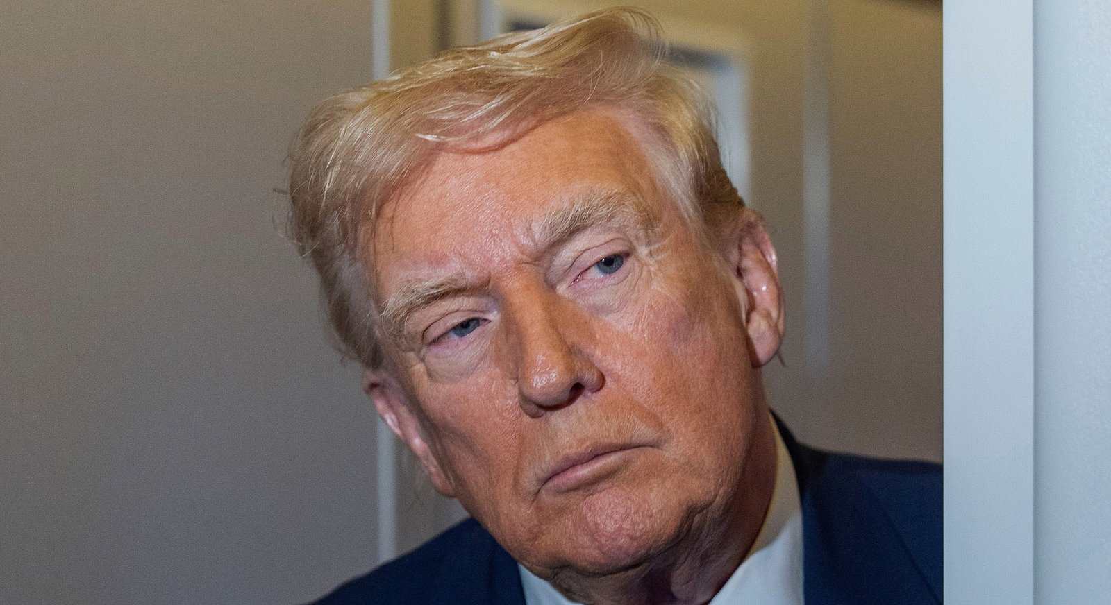 White House Memo Reports Normal Cardiac and Abdominal Imaging for President Trump - Imagem do artigo original