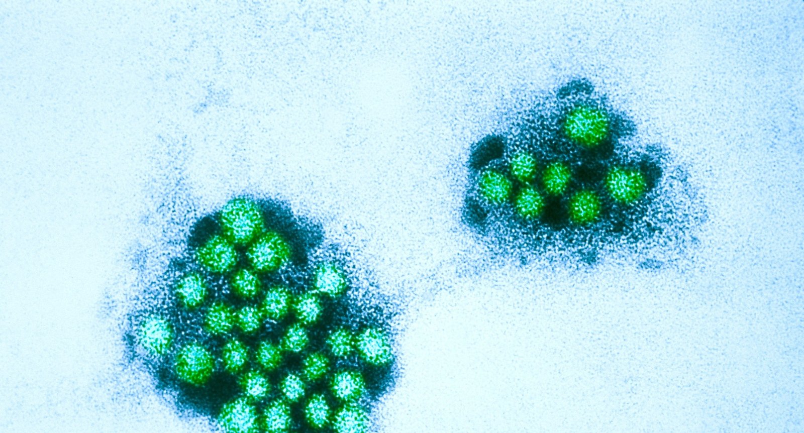 Wastewater Surveillance Shows Significant Norovirus Uptick in Los Angeles County - Imagem do artigo original